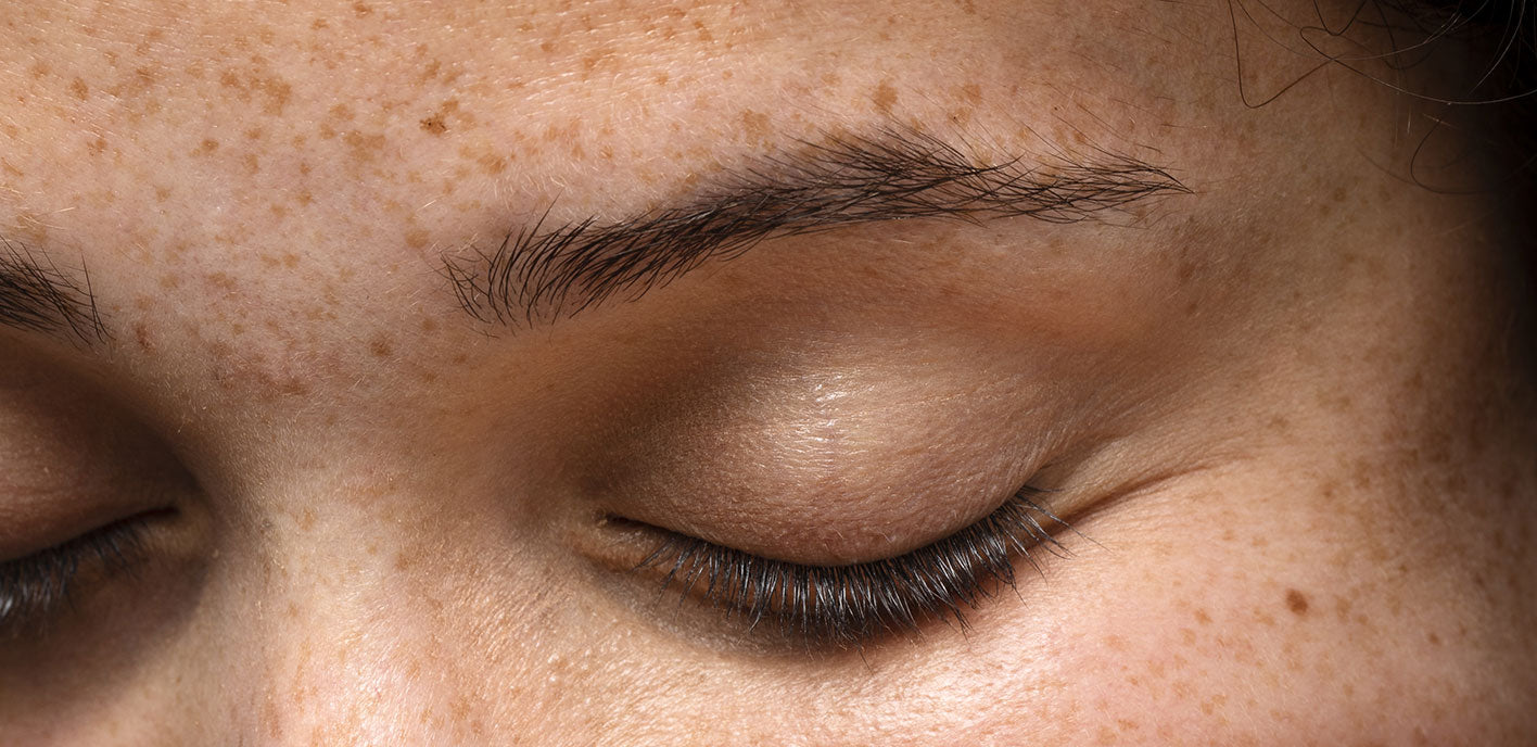 Comment soulager naturellement les irritations du visage ?-Najel